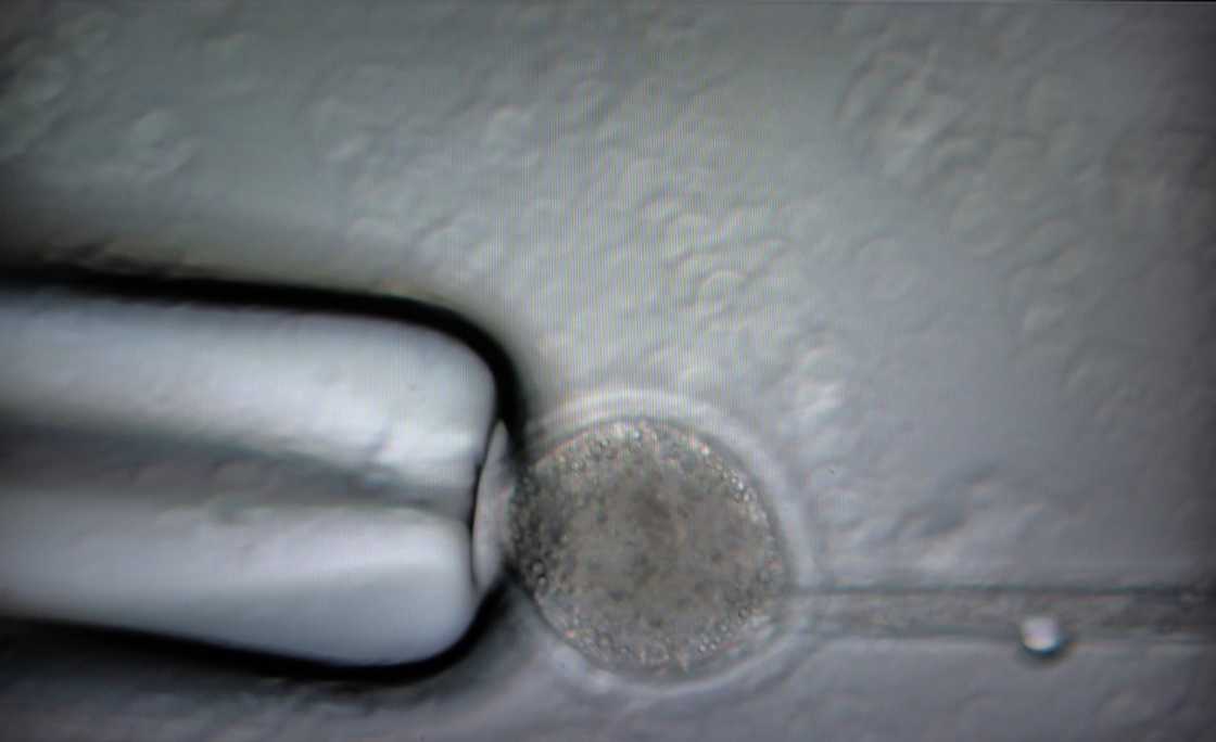 DNA is removed from an  oocyte before being injected with genetic modifications at the Revivicor Laboratories, in Blacksburg, Virginia, on November 22, 2024