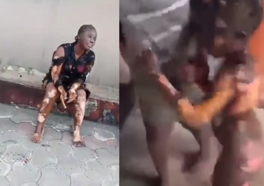 Graphic video: Gas explosion roasts pregnant woman, 15 others in Rivers