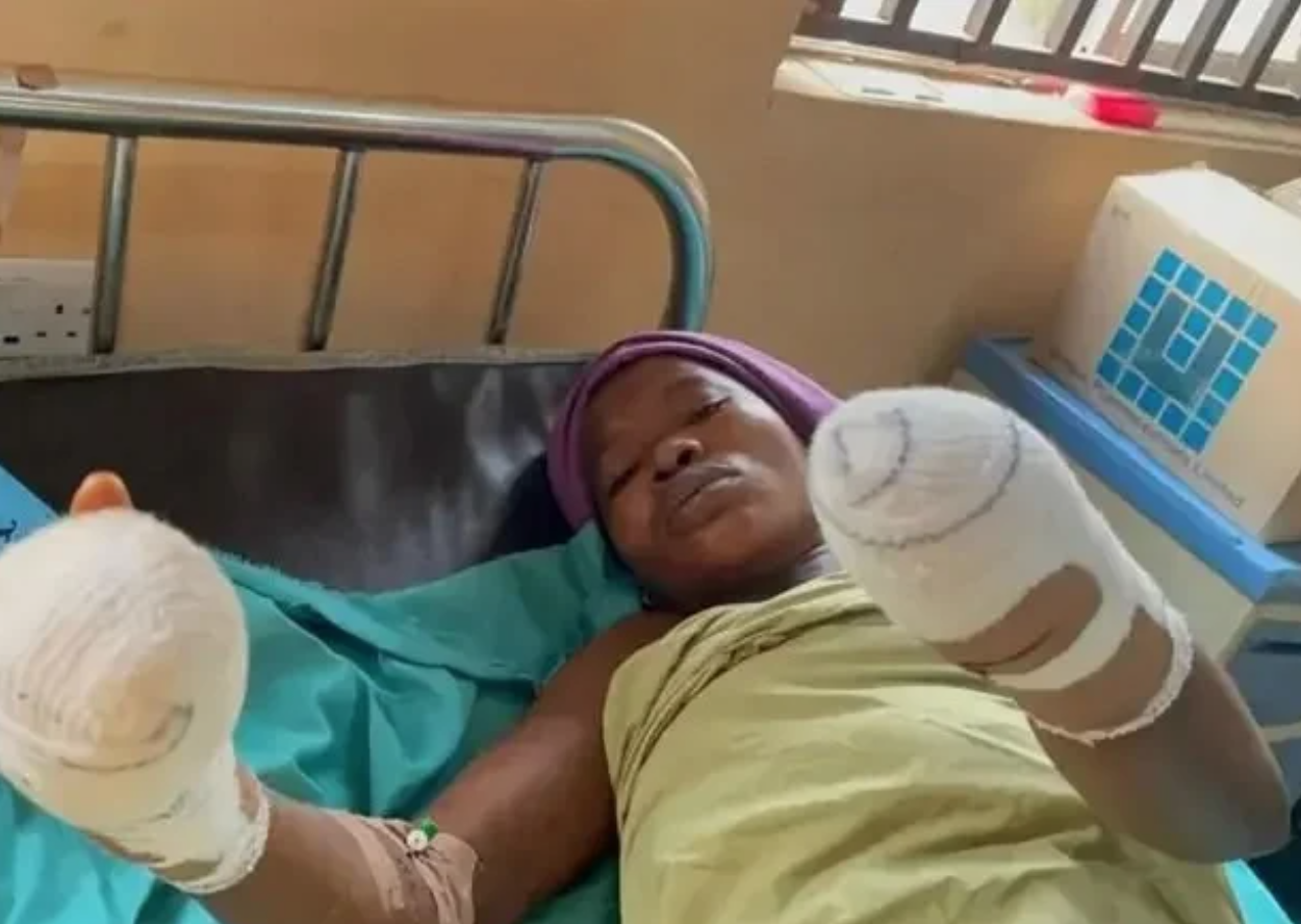 ‘How my husband used knife to cut off my hands’ — Nigerian woman opens up