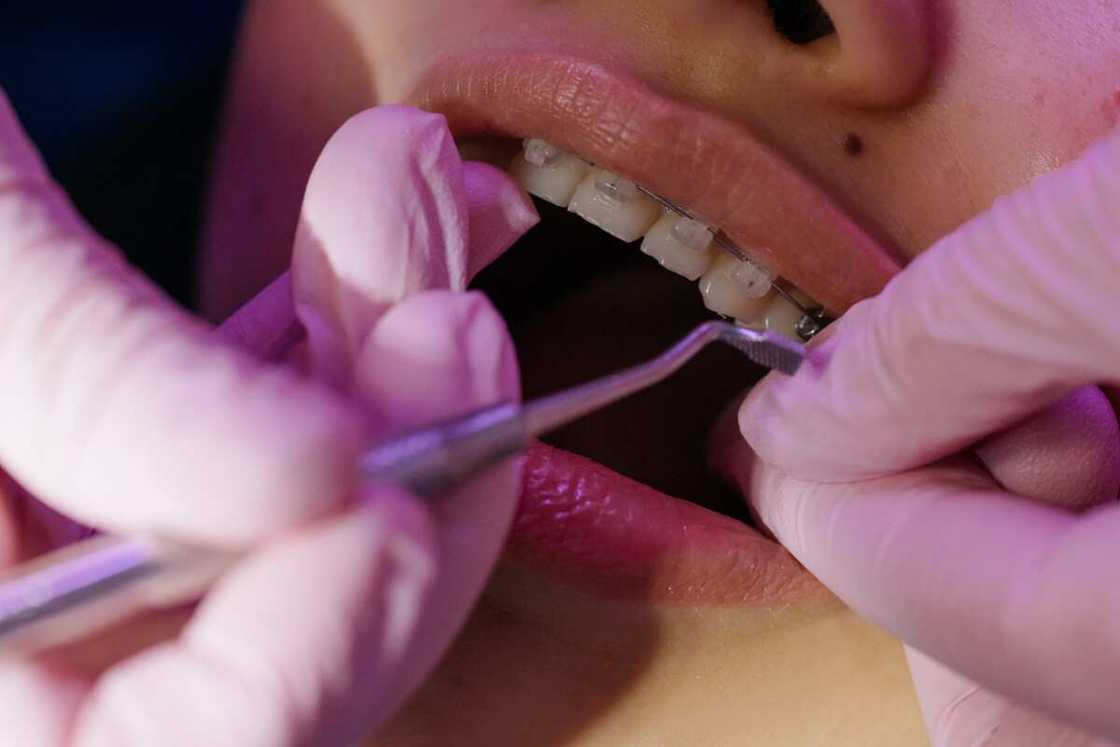 A dentist treating a tooth with braces